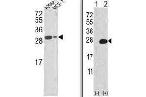 Image no. 1 for anti-Adenine Phosphoribosyltransferase (APRT) (N-Term) antibody (ABIN452753) (APRT antibody  (N-Term))