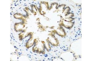 Immunohistochemistry of paraffin-embedded Rat lung using S100A7 Polyclonal Antibody at dilution of 1:100 (40x lens). (S100A7 antibody)