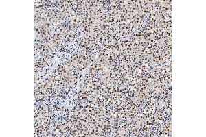 IHC analysis of SNRNP200 using anti-SNRNP200 antibody (ABIN7602032). (SNRNP200 antibody  (AA 557-2129))