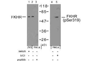 Image no. 1 for anti-Forkhead Box O1 (FOXO1) (Ser319) antibody (ABIN197366) (FOXO1 antibody  (Ser319))