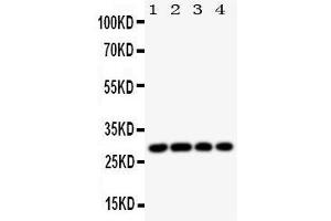 Western Blotting (WB) image for anti-Major Histocompatibility Complex, Class II, DM beta (HLA-DMB) (AA 81-100), (Middle Region) antibody (ABIN3044175) (HLA-DMB antibody  (Middle Region))