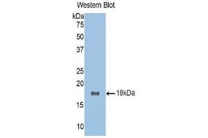 Western Blotting (WB) image for anti-R-Spondin 1 (RSPO1) (AA 136-262) antibody (ABIN1171732) (RSPO1 antibody  (AA 136-262))