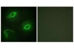 Immunofluorescence analysis of HeLa cells, using LATH antibody. (BPIFA4P antibody)