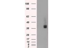 HEK293T cells were transfected with the pCMV6-ENTRY control (Left lane) or pCMV6-ENTRY BSG (Right lane) cDNA for 48 hrs and lysed. (CD147 antibody)