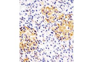 (ABIN390772 and ABIN2841030) staining Hsp 60 in human pancreas sections by Immunohistochemistry (IHC-P - paraformaldehyde-fixed, paraffin-embedded sections). (HSPD1 antibody  (N-Term))