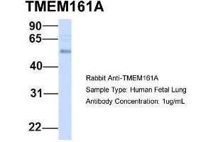 Host:  Rabbit  Target Name:  TMEM161A  Sample Type:  Human Fetal Lung  Antibody Dilution:  1. (TMEM161A antibody  (Middle Region))