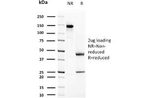 SDS-PAGE Analysis Purified Prolactin Mouse Monoclonal Antibody (PRL/2644). (Prolactin antibody  (AA 63-201))