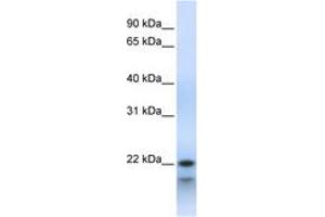 Image no. 1 for anti-Polymerase (RNA) III (DNA Directed) Polypeptide H (22.9kD) (POLR3H) (C-Term) antibody (ABIN6743479) (POLR3H antibody  (C-Term))