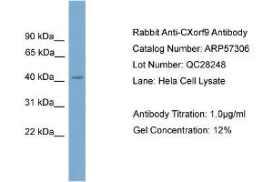 WB Suggested Anti-CXorf9  Antibody Titration: 0.