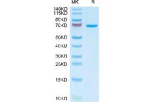 alpha Fetoprotein Protein (AA 19-609) (His tag)