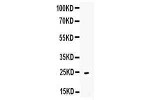 Western blot analysis of CD252 using anti-CD252 antibody . (TNFSF4 antibody  (AA 49-198))
