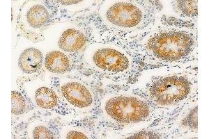 ABIN6258133 and ABIN6275167 at 1/100 staining human normal colon tissue by IHC-P.