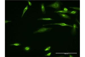 Immunofluorescence (IF) image for anti-VAMP (Vesicle-Associated Membrane Protein)-Associated Protein A, 33kDa (VAPA) (AA 1-242) antibody (ABIN522677)