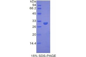 SDS-PAGE analysis of Mouse Dystrophin Protein. (Dystrophin Protein (DMD))