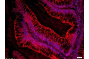 Paraformaldehyde-fixed, paraffin embedded human colon cancer, Antigen retrieval by boiling in sodium citrate buffer (pH6) for 15min, Block endogenous peroxidase by 3% hydrogen peroxide for 30 minutes, Blocking buffer (normal goat serum) at 37°C for 20min, Antibody incubation with 	Rabbit Anti-FZD3/Frizzled 3 Polyclonal Antibody, Unconjugated ( 	 ) at 1:200 overnight at 4°C, followed by the secondary antibody was Goat Anti-Rabbit IgG, Cy3 conjugated-Cy)and used at 1:200 dilution for 40 minutes at 37°CDAPI(5ug/ml) was used to stain the cell nuclei (FZD3 antibody  (AA 121-220))