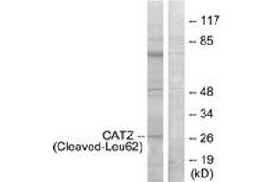 Western blot analysis of extracts from COS7 cells, treated with etoposide 25uM 1h, using CATZ (Cleaved-Leu62) Antibody.