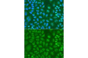 Immunofluorescence analysis of A-549 cells using CXXC1 antibody. (CXXC1 antibody  (AA 1-210))