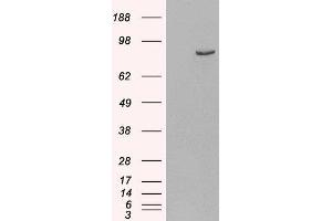 HEK293 overexpressing Human PDE4B and probed with ABIN2564508 (mock transfection in first lane). (PDE4B antibody  (C-Term))