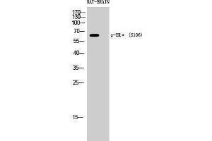 Western Blotting (WB) image for anti-Estrogen Receptor 1 (ESR1) (pSer106) antibody (ABIN3182002) (Estrogen Receptor alpha antibody  (pSer106))