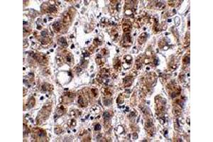 Immunohistochemistry of ACOT13 in human liver tissue with ACOT13 polyclonal antibody  at 2.