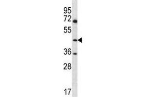 ASS1 antibody western blot analysis in Jurkat lysate (ASS1 antibody  (AA 281-310))