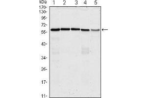 Western blot analysis using anti-CDC25C mAb against Hela (1), K562 (2), PC-3 (3), HEK293 (4) and Raw264. (CDC25C antibody)