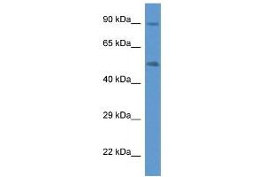 Western Blot showing CYP2W1 antibody used at a concentration of 1 ug/ml against Fetal Lung Lysate (CYP2W1 antibody  (C-Term))
