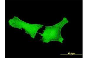 Immunofluorescence of purified MaxPab antibody to GPATCH2 on HeLa cell. (GPATCH2 antibody  (AA 1-376))