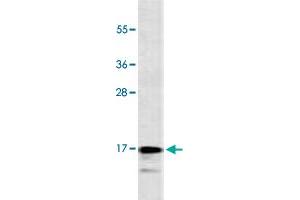 Western Blot analysis of CEM cell lysate (35 ug/lane) with CALCA monoclonal antibody, clone 406CT21.