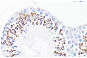 Immunohistochemistry of paraffin-embedded Mouse testis using CAMP Polyclonal Antibody at dilution of 1:200 (40x lens). (Cathelicidin antibody)