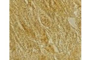 Immunohistochemistry of BACE2 in rat heart tissue with BACE2 antibody at 2 μg/ml. (BACE2 antibody  (C-Term))