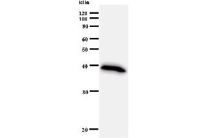 Western Blotting (WB) image for anti-Bromodomain and PHD Finger Containing, 1 (BRPF1) antibody (ABIN933002) (BRPF1 antibody)