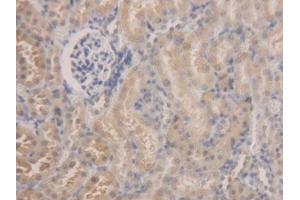 DAB staining on IHC-P; Samples: Rat Kidney Tissue (ALDH7A1 antibody  (AA 28-539))