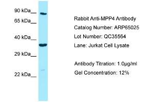 Western Blotting (WB) image for anti-Membrane Protein, Palmitoylated 4 (MAGUK P55 Subfamily Member 4) (MPP4) (C-Term) antibody (ABIN971167) (MPP4 antibody  (C-Term))