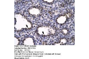 Human Lung (HMGB2 antibody  (C-Term))