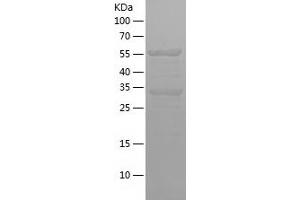Ataxin 2-Like Protein (ATXN2L) (AA 736-947) (His-IF2DI Tag)