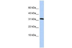 DYSFIP1 antibody used at 1 ug/ml to detect target protein. (PPP1R27 antibody  (Middle Region))