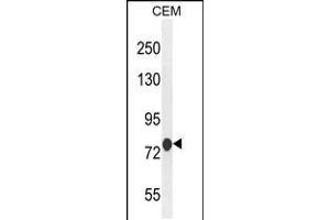 Western blot analysis in CEM cell line lysates (35ug/lane). (ATF7IP2 antibody  (AA 318-347))