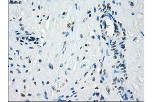 Immunohistochemical staining of paraffin-embedded Kidney tissue using anti-KDM4C mouse monoclonal antibody. (KDM4C antibody)