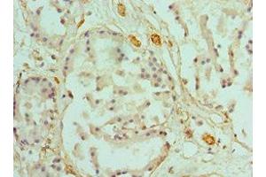Immunohistochemistry of paraffin-embedded human prostate tissue using ABIN7146462 at dilution of 1:100 (Caldesmon antibody  (AA 1-240))