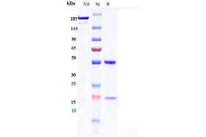 Anti-HGFR / c-Met Reference Antibody (SAIT301) on SDS-PAGE under reducing (R) condition.