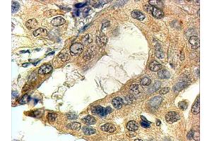 ABIN2560130 (4µg/ml) staining of paraffin embedded Human Prostate. (SRD5A1 antibody  (N-Term))