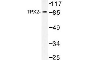 Image no. 2 for anti-TPX2, Microtubule-Associated, Homolog (Xenopus Laevis) (TPX2) antibody (ABIN317807) (TPX2 antibody)