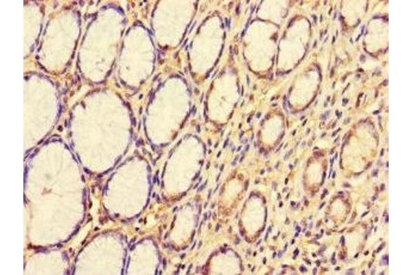 CDS1 antibody  (AA 6-85)