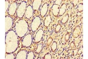 Immunohistochemistry of paraffin-embedded human stomach tissue using ABIN7163108 at dilution of 1:100 (CDS1 antibody  (AA 6-85))