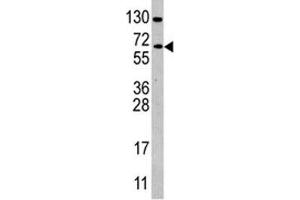 Western Blotting (WB) image for anti-Cell Division Cycle 25 Homolog B (S. Pombe) (CDC25B) (AA 331-360) antibody (ABIN3030451)