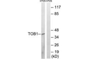 Western blot analysis of extracts from HT29 cells treated with serum 20% 15', using TOB1 (Phospho-Ser164) Antibody. (Protein Tob1 (TOB1) (AA 130-179), (pSer164) antibody)