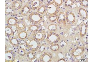 Formalin-fixed and paraffin embedded human kidney labeled with Rabbit Anti-AQP5 Polyclonal Antibody, Unconjugated  at 1:200 followed by conjugation to the secondary antibody and DAB staining