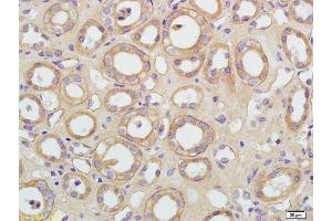 Formalin-fixed and paraffin embedded human kidney labeled with Rabbit Anti-AQP5 Polyclonal Antibody, Unconjugated  at 1:200 followed by conjugation to the secondary antibody and DAB staining (Aquaporin 5 antibody  (AA 201-265))
