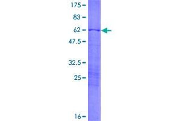 Fibrillarin Protein (FBL) (AA 1-321) (GST tag)